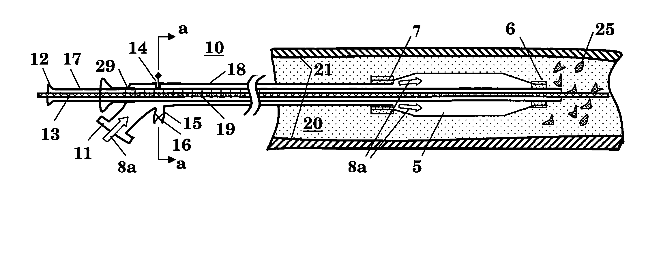 Balloon catheter