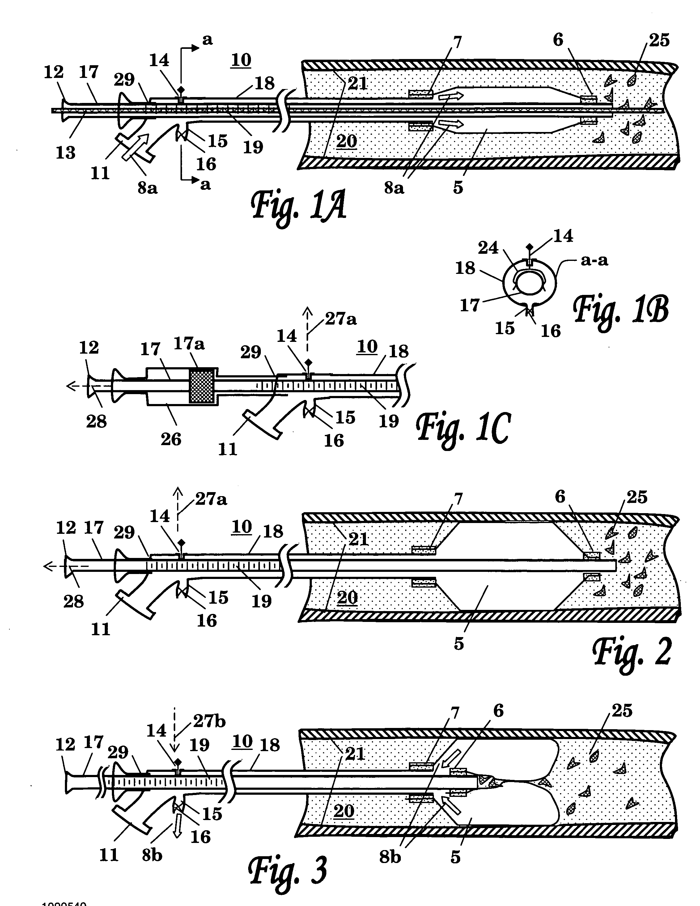 Balloon catheter