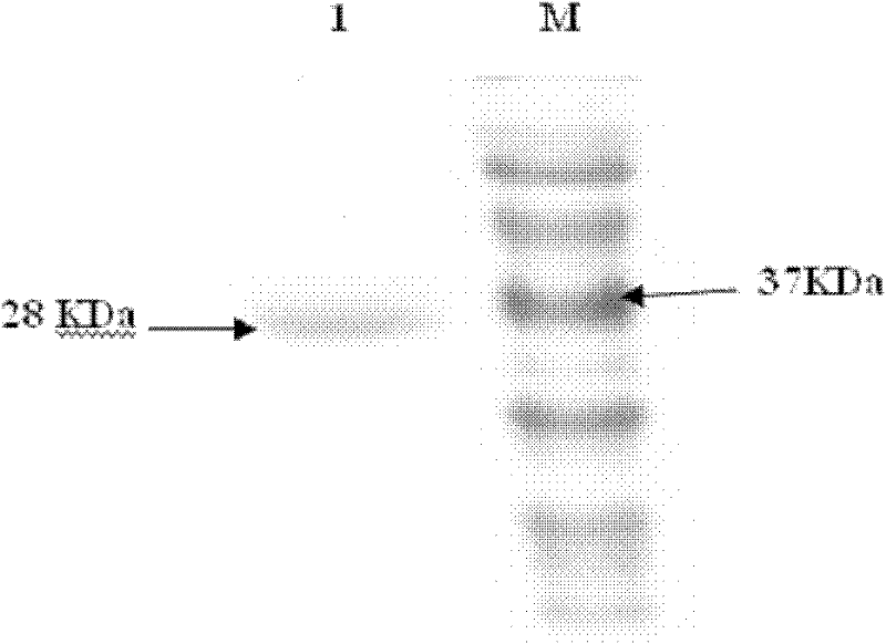 Zearalenone toxin degradation enzyme and coding gene and application thereof