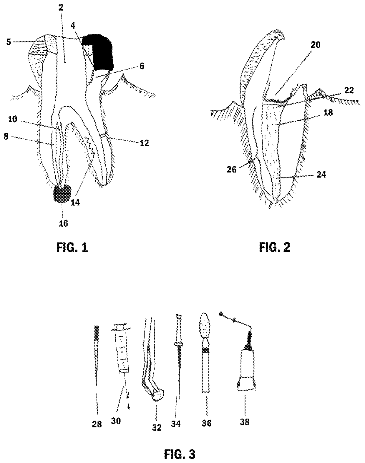 System and method of in vivo testing for recently viable dental cellular debris