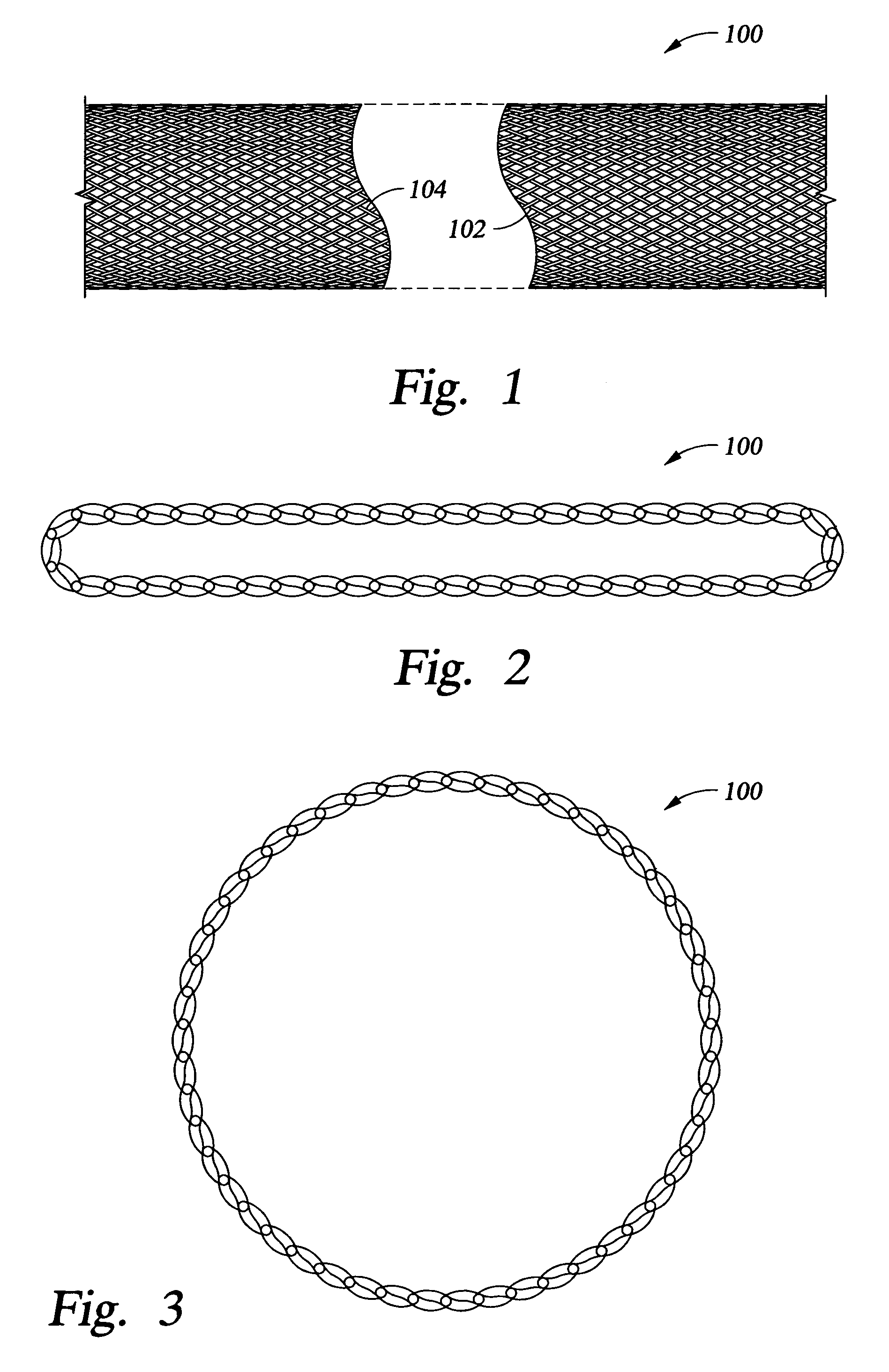 Systems and methods for placing a braided, tubular sleeve in a well bore