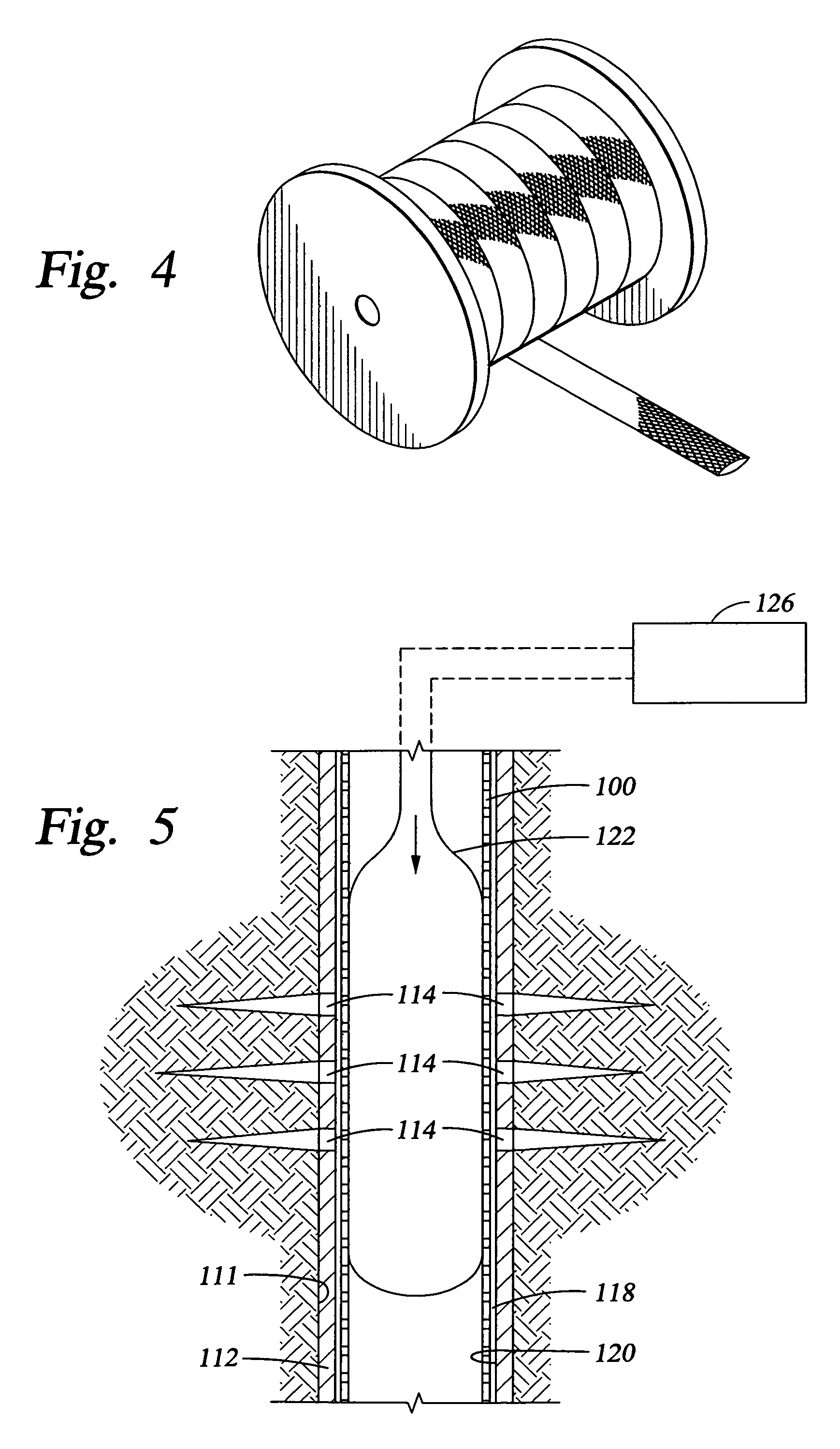 Systems and methods for placing a braided, tubular sleeve in a well bore