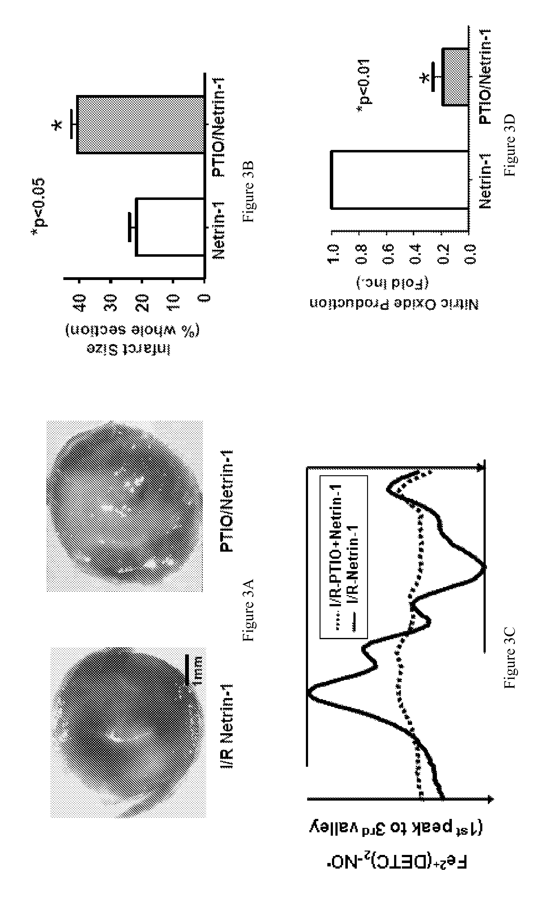 Method of treating ischemia/reperfusion injuries to a heart with netrin-1