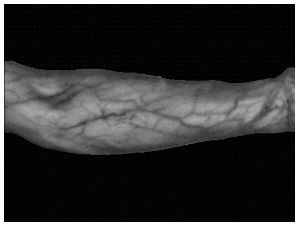 Mobile phone end vein imaging method based on deep learning