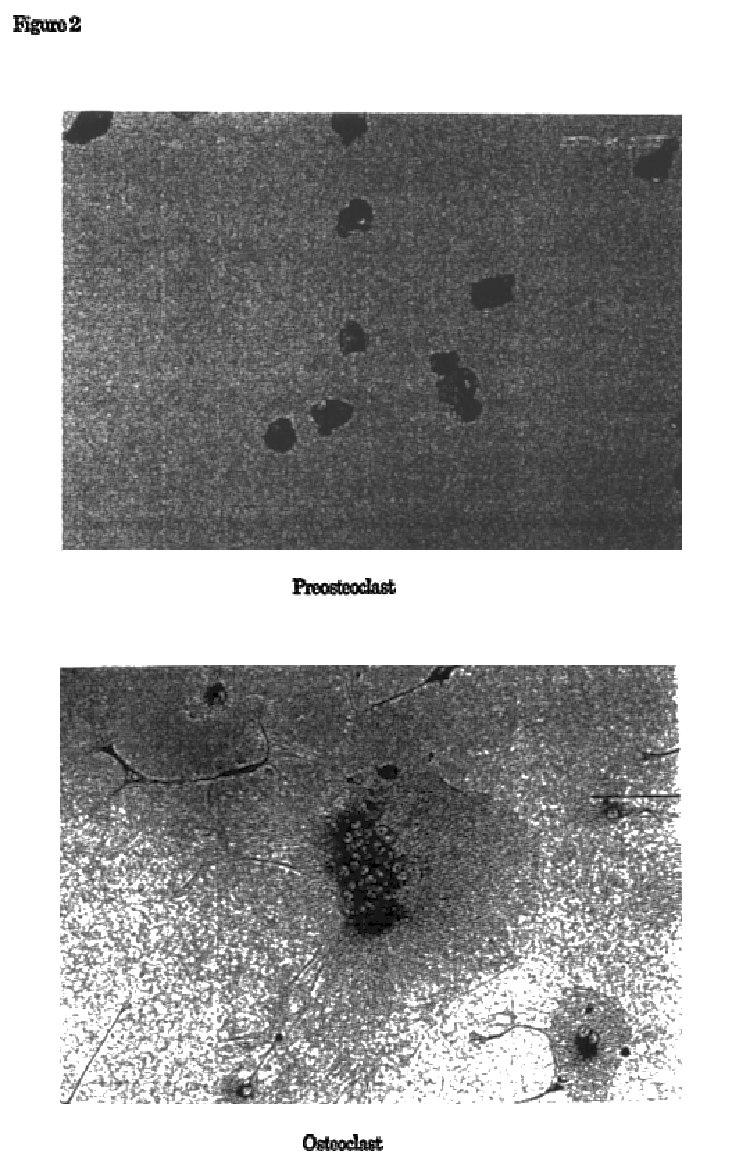 Methods for isolation of osteoclast precursor cells and inducing their differentiation into osteoclasts