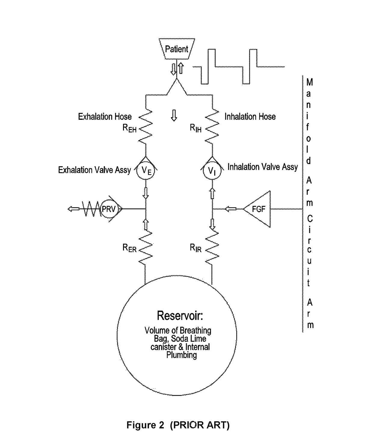 Method and apparatus for facilitating delivery of anaesthetic