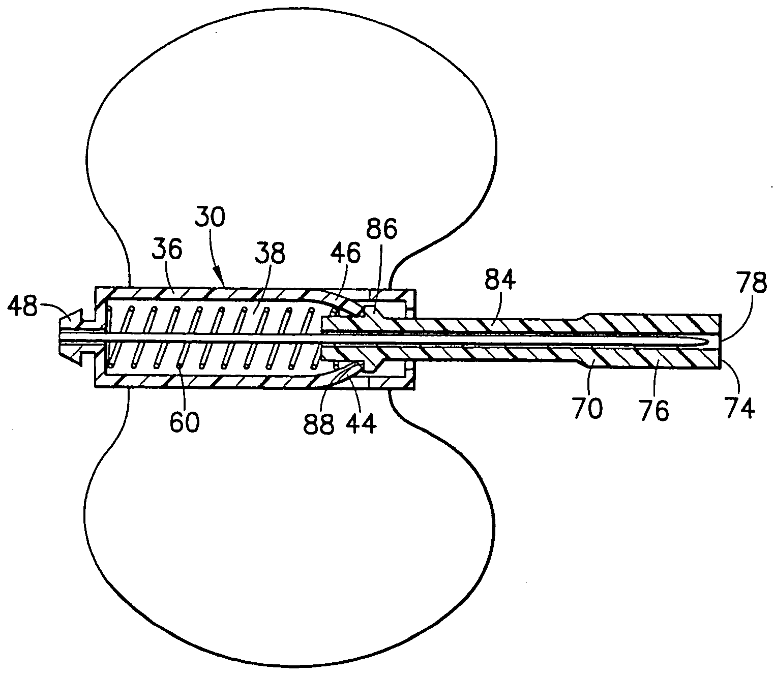 Selectively passive forward shielding medical needle device