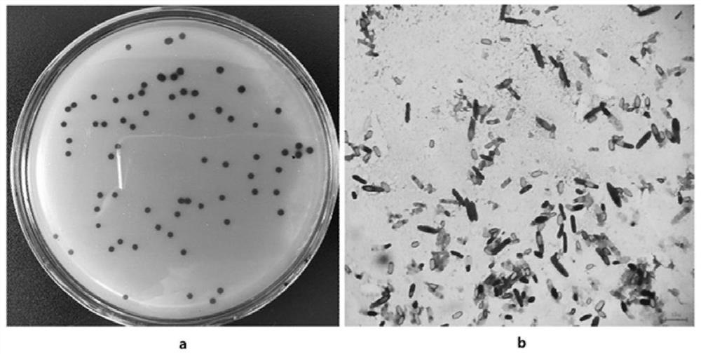 Compound preparation containing clostridium butyricum and pediococcus acidilactici as well as preparation method and application of compound preparation