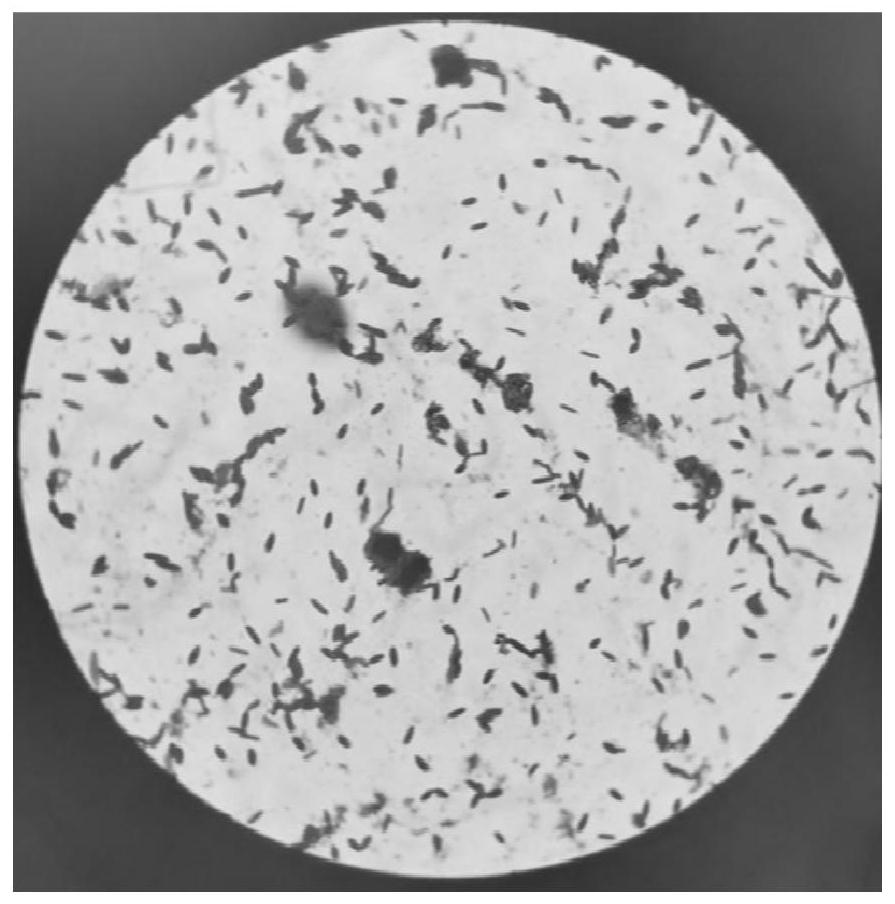 Compound preparation containing clostridium butyricum and pediococcus acidilactici as well as preparation method and application of compound preparation