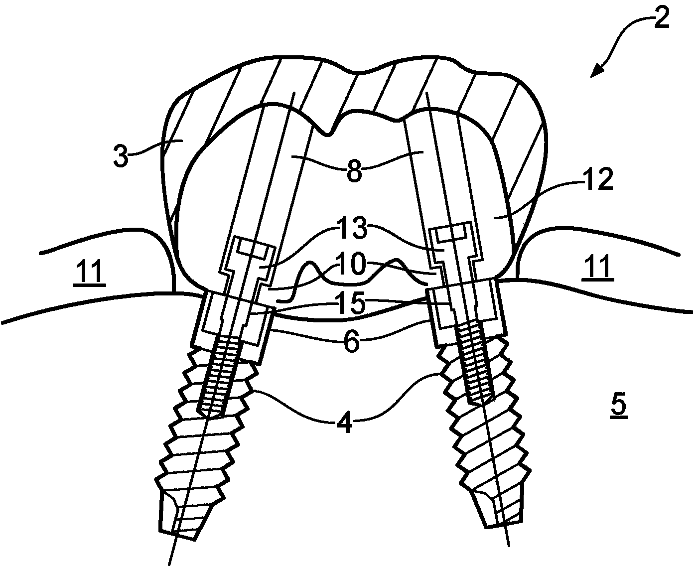 Method of manufacturing an article