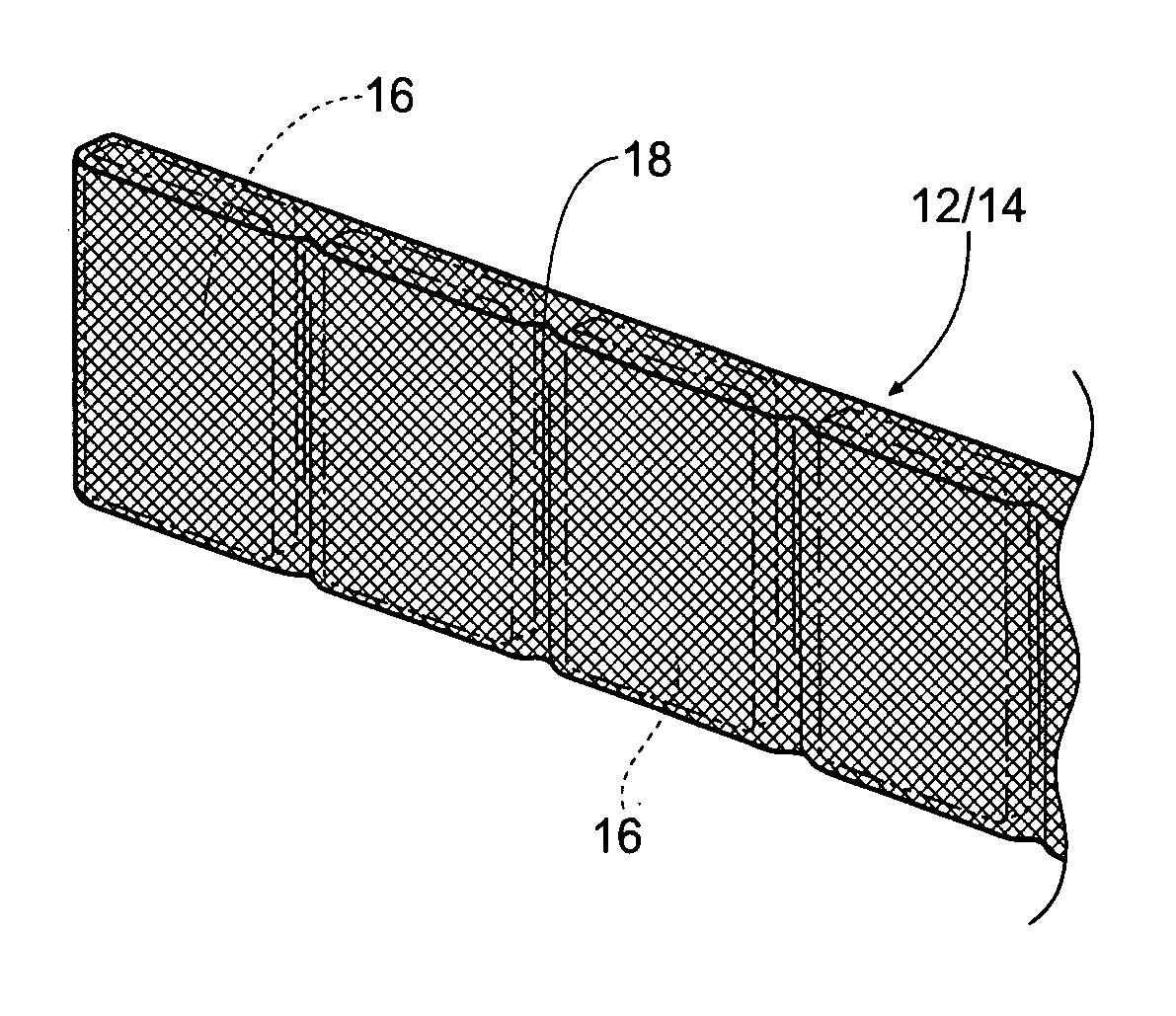 Devices, systems, and methods to fixate tissue within the regions of the body, such as the pharyngeal conduit