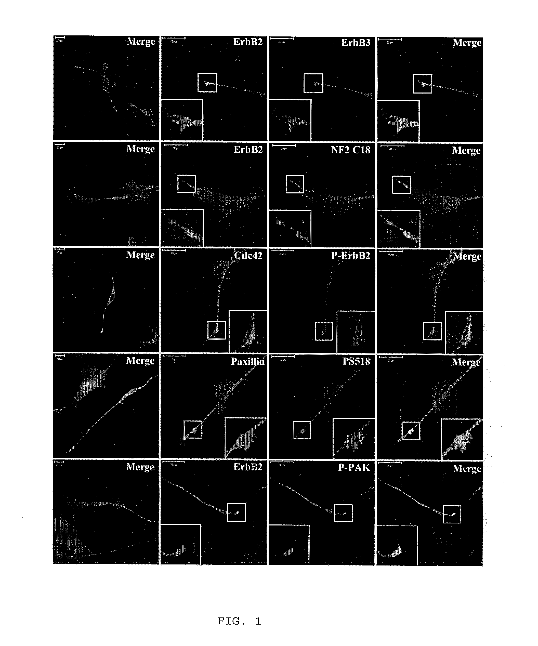 Methods of inducing and preventing neurofibromatosis in schwann cells