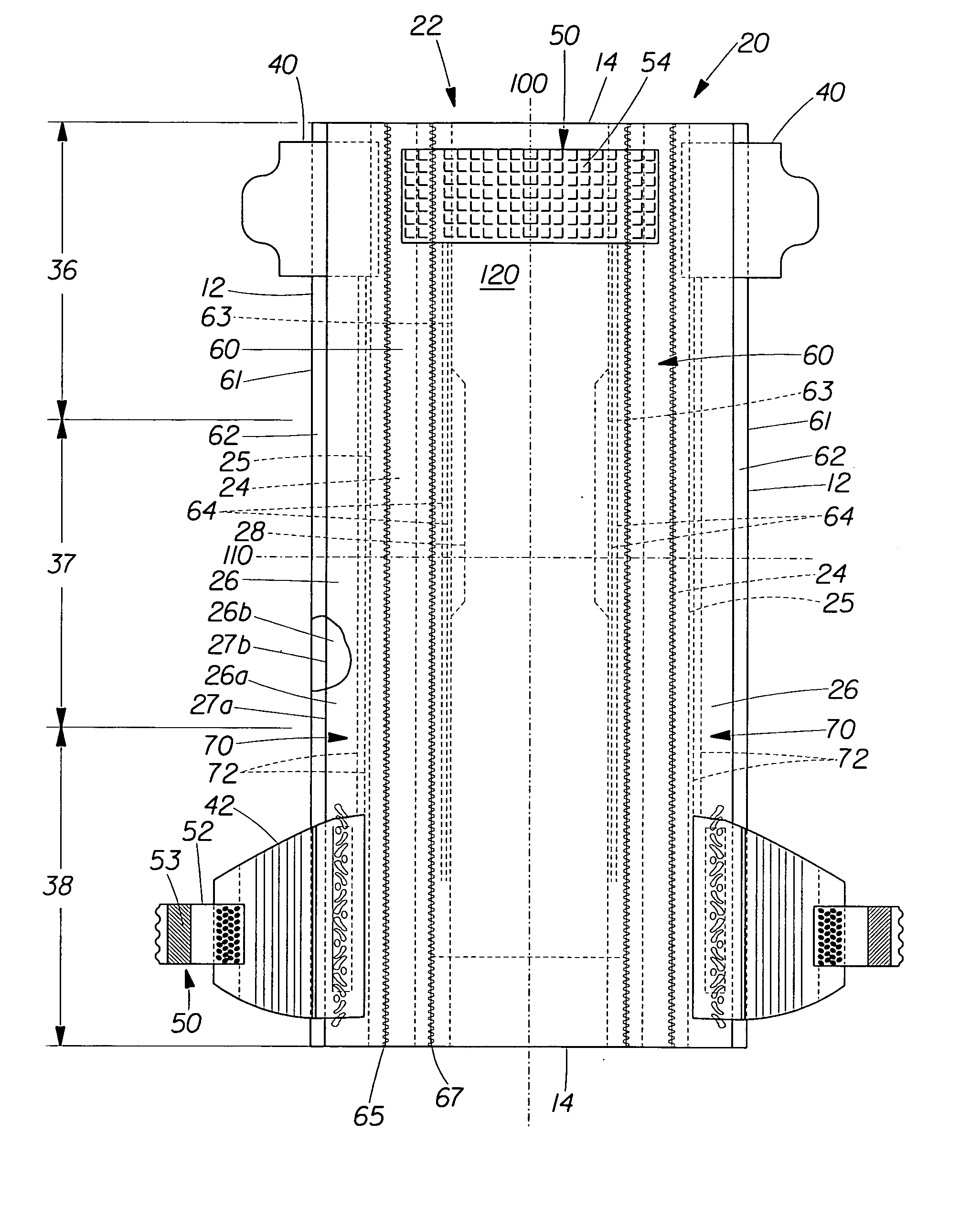 Absorbent article comprising auxetic materials