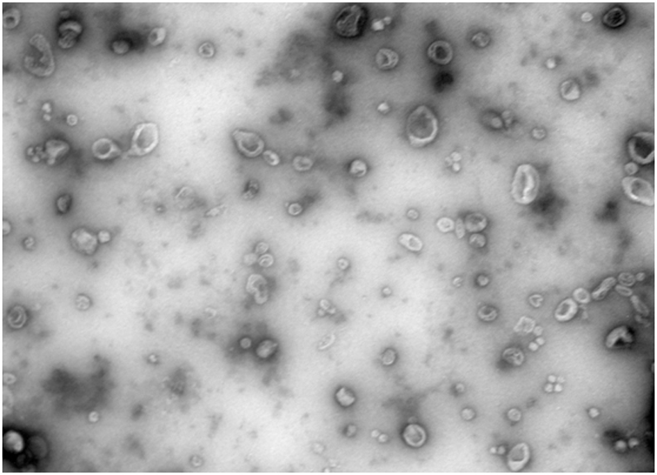 Exosome separation and purification method