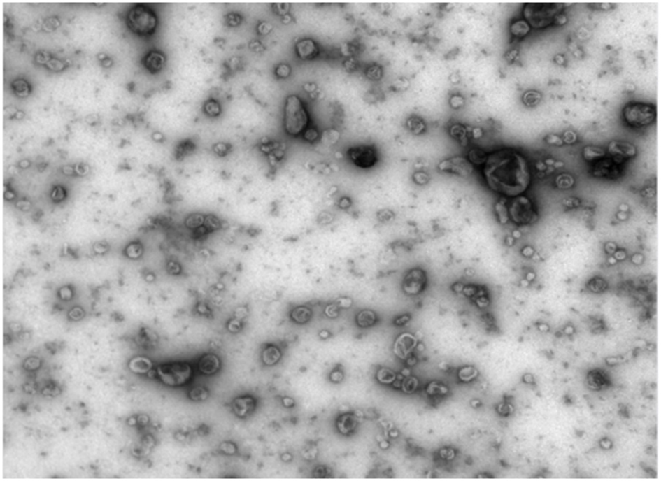 Exosome separation and purification method