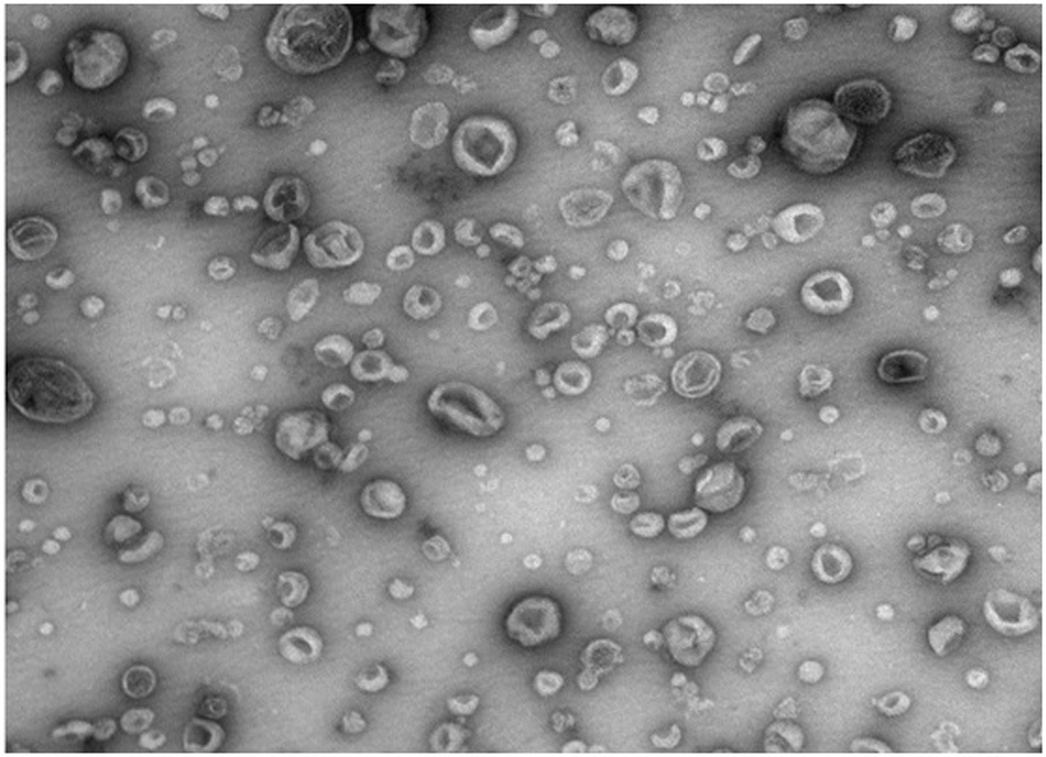 Exosome separation and purification method