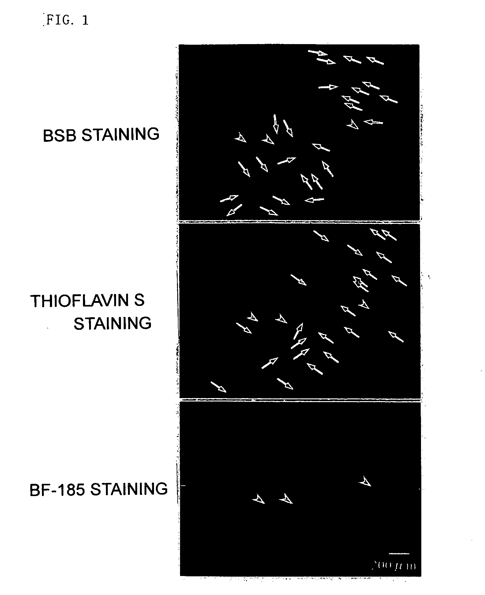 Probe for diseases with amyloid accumulation, amyloid-staining agent, remedy and preventive for diseases with amyloid accumulation and diagnostic probe and staining agent for neurofibrillary change