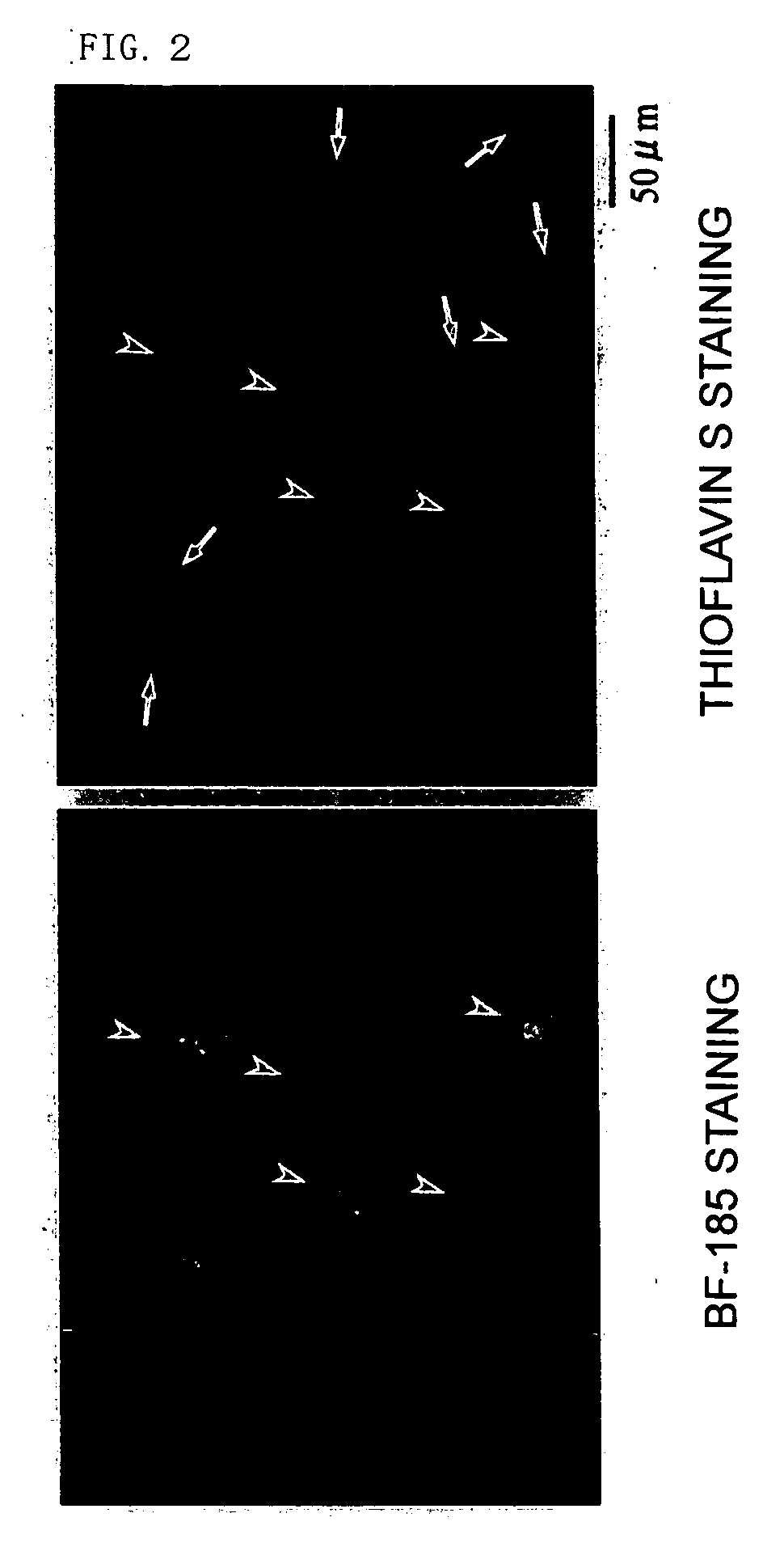 Probe for diseases with amyloid accumulation, amyloid-staining agent, remedy and preventive for diseases with amyloid accumulation and diagnostic probe and staining agent for neurofibrillary change