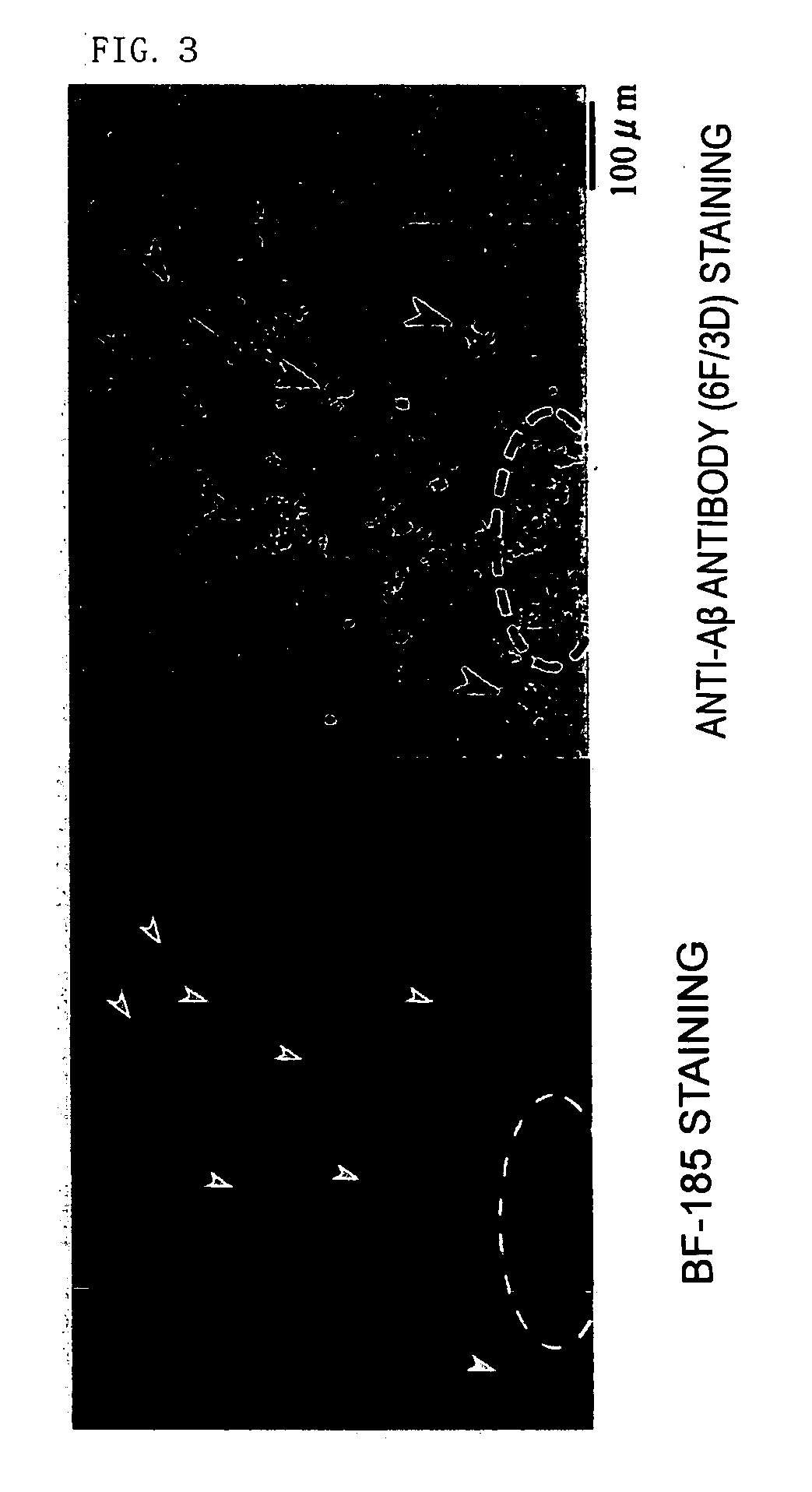 Probe for diseases with amyloid accumulation, amyloid-staining agent, remedy and preventive for diseases with amyloid accumulation and diagnostic probe and staining agent for neurofibrillary change