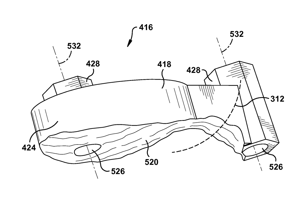 System and method for association of a guiding aid with a patient tissue