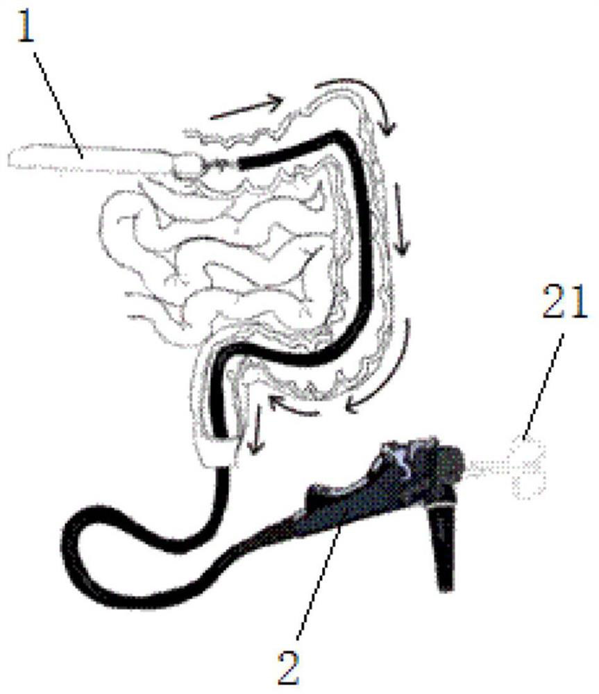 Specimen holding device for right hemicolon NOSES surgery and application method thereof