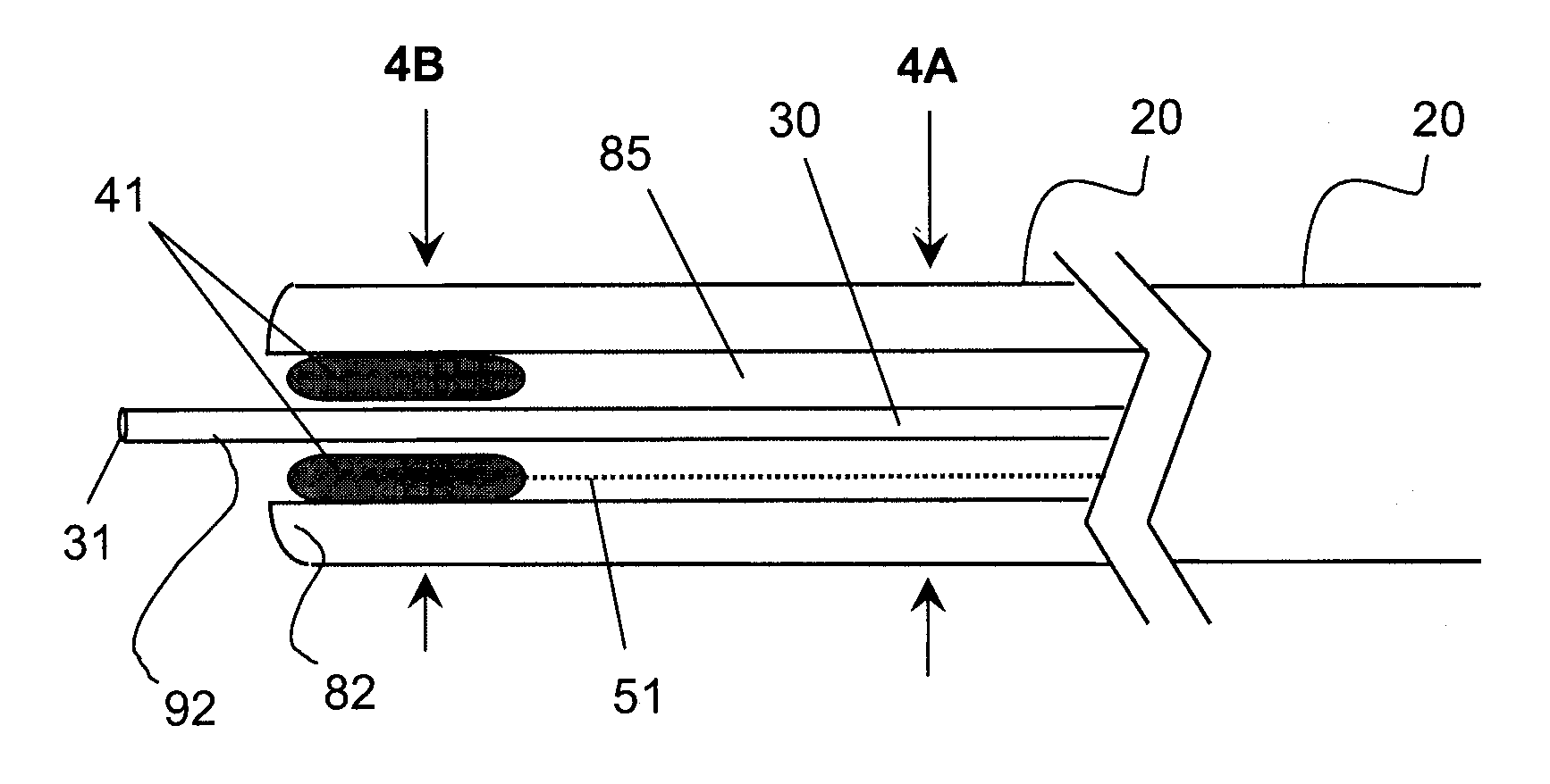 Apparatus and method for guided chronic total occlusion penetration