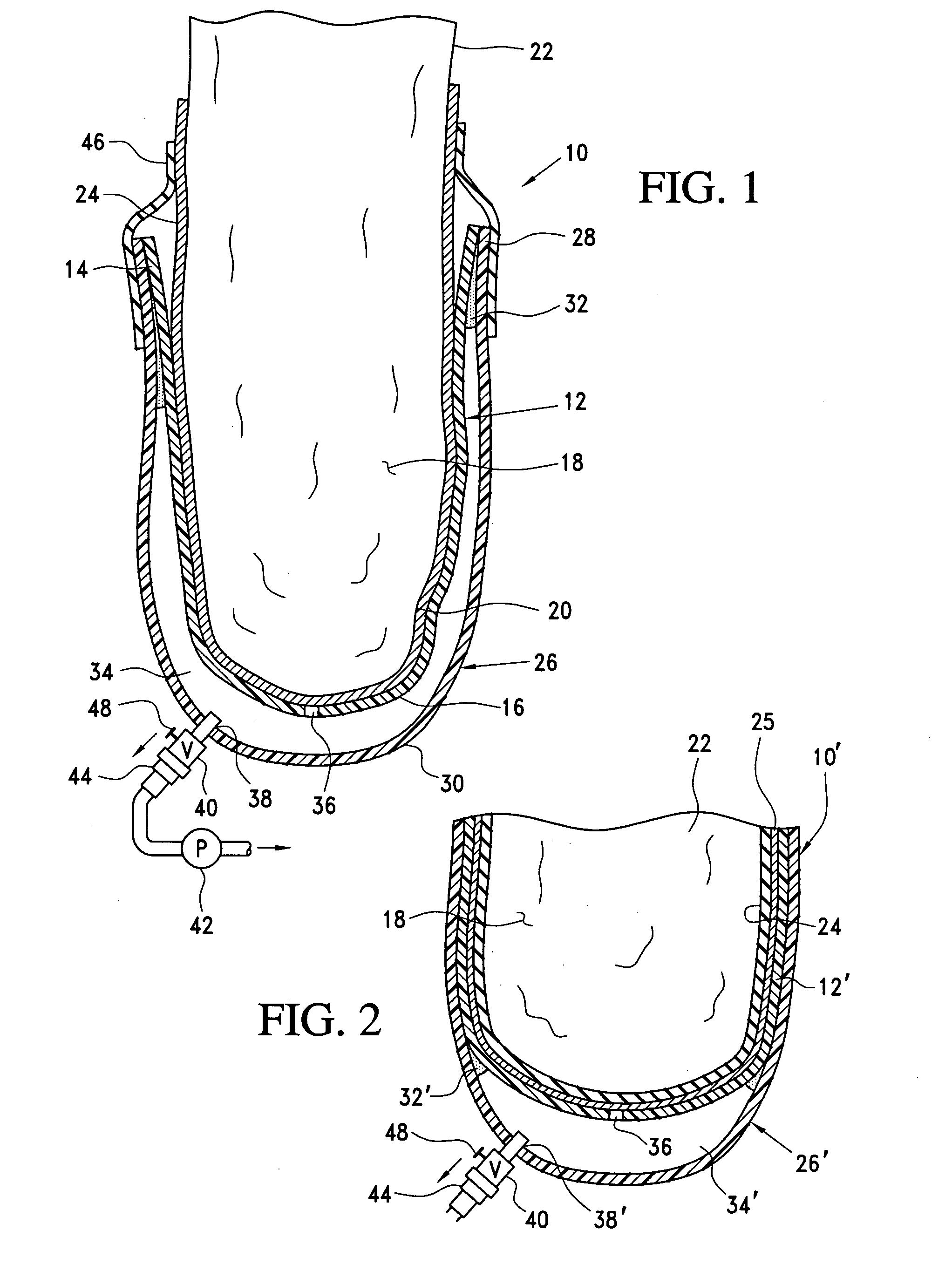 Prosthetic socket with self-contained vacuum reservoir