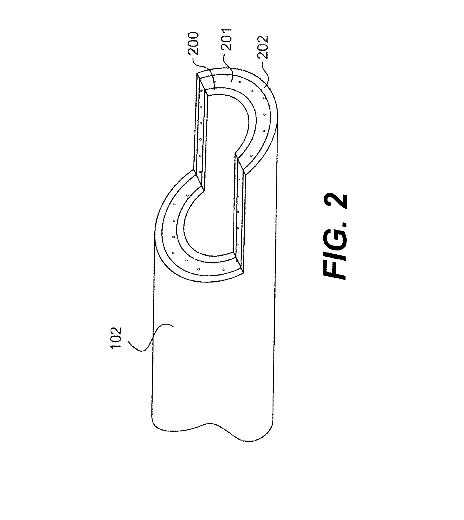 Endovascular devices and methods