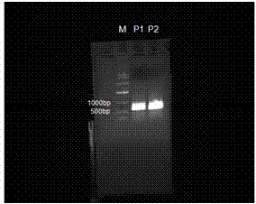 Application of peroxidase to preparation of drug for preventing and treating cerebrovascular diseases