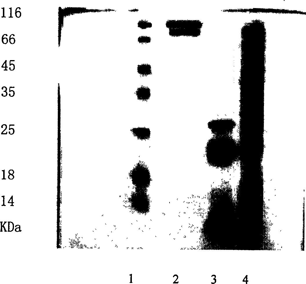 Separation and purification process for acellular whooping cough antigen albumen