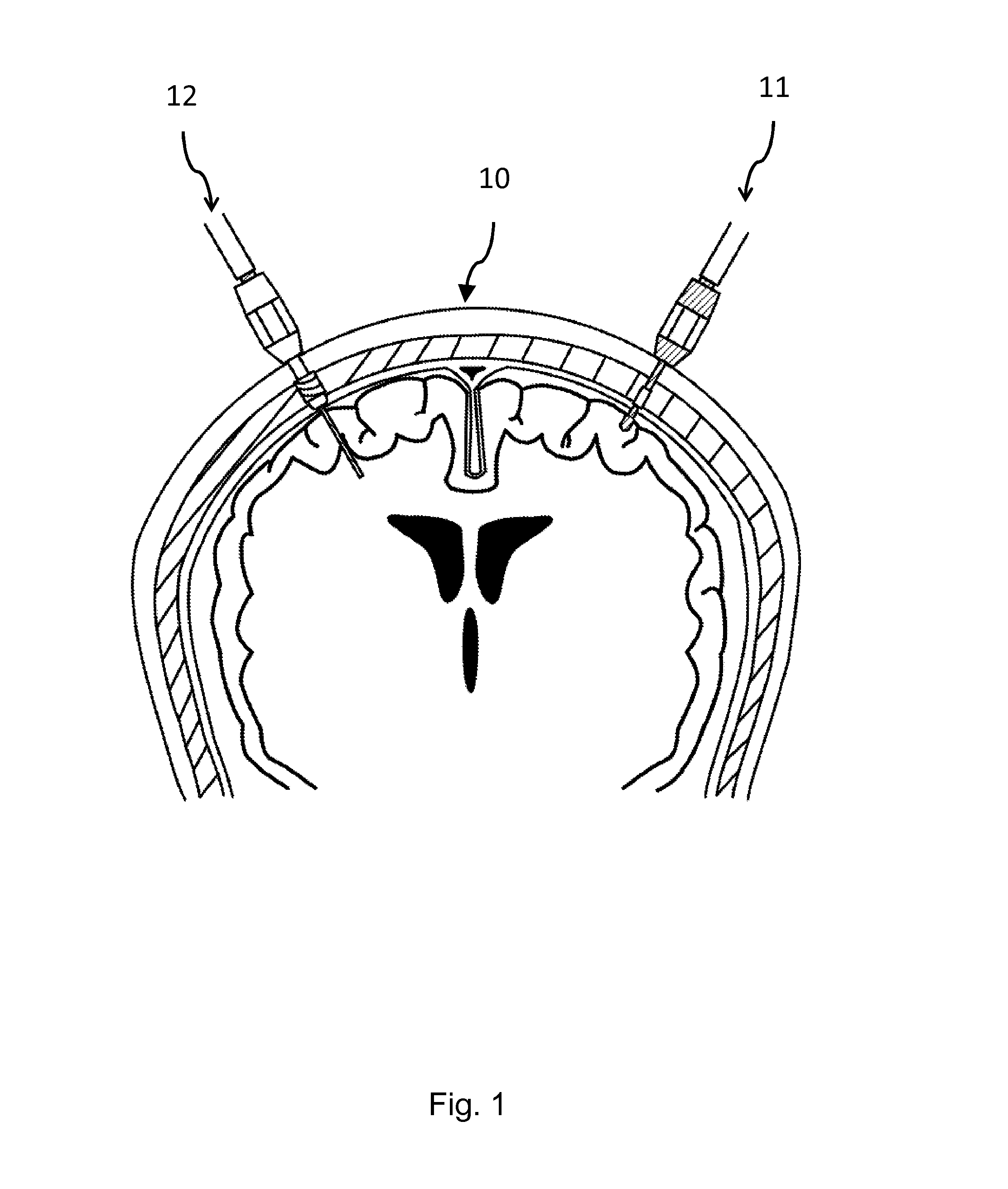 Wireless detection system of physiological signals and method thereof