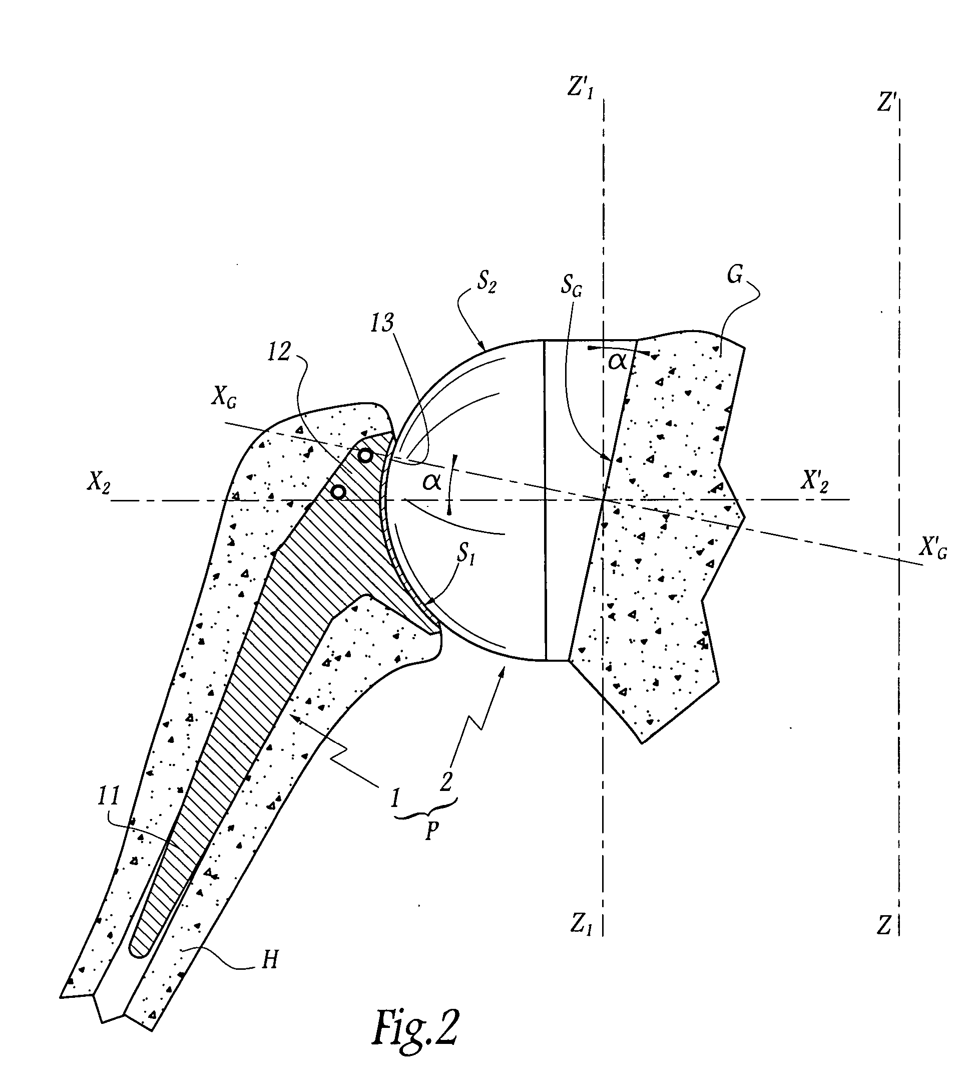 Glenoidal component, set of such components and shoulder prosthesis incorporating such a glenoidal component