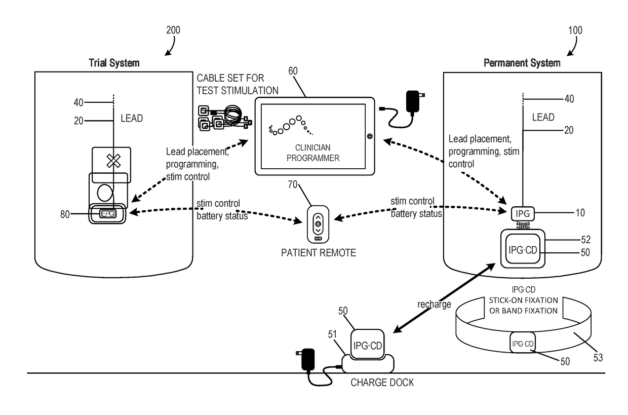 Antenna and methods of use for an implantable nerve stimulator