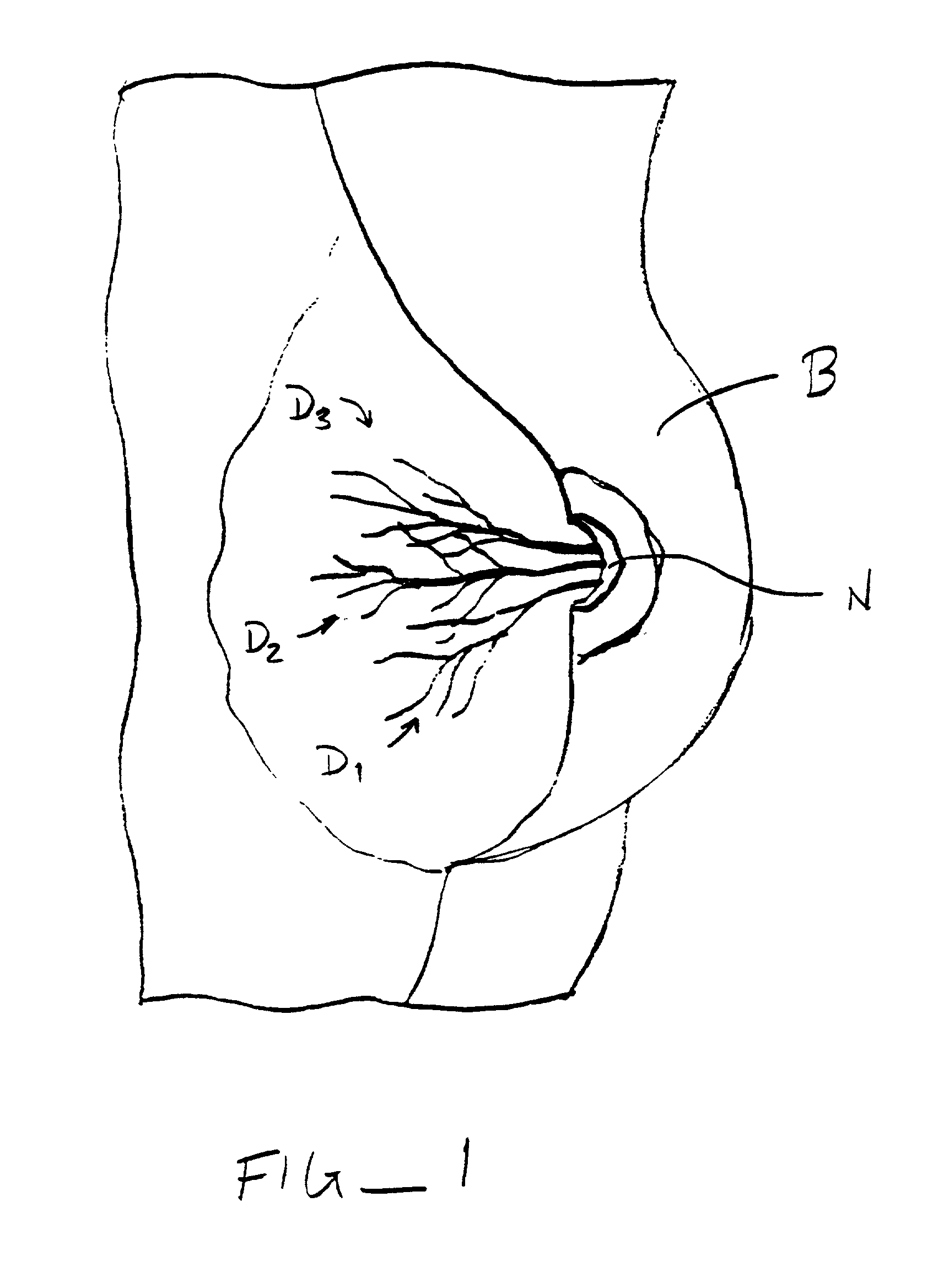 Methods and kits for indentifying ductal orifices in a nipple