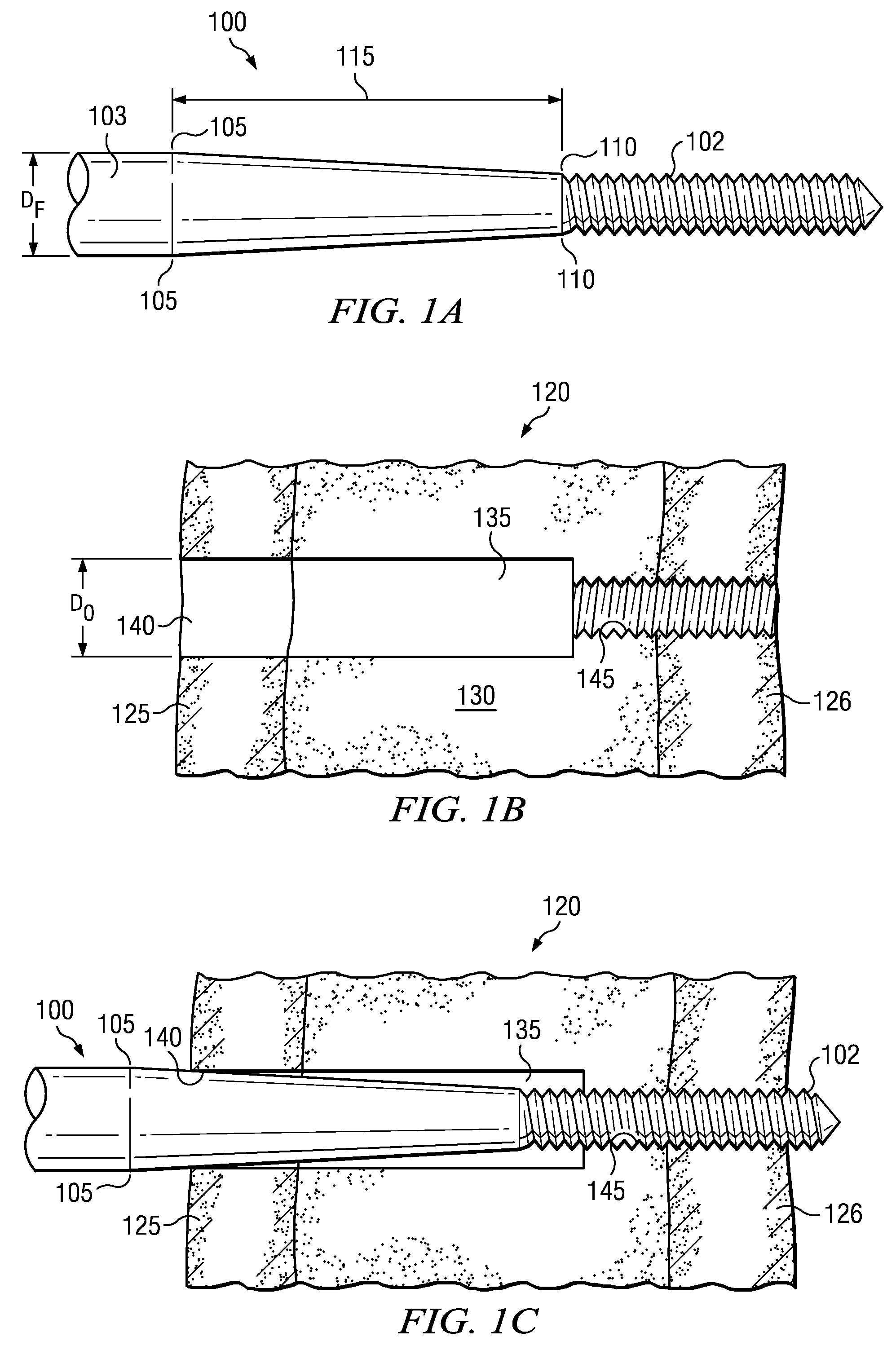 Tapered threaded orthopedic fastener engaging predetermined radial preloads