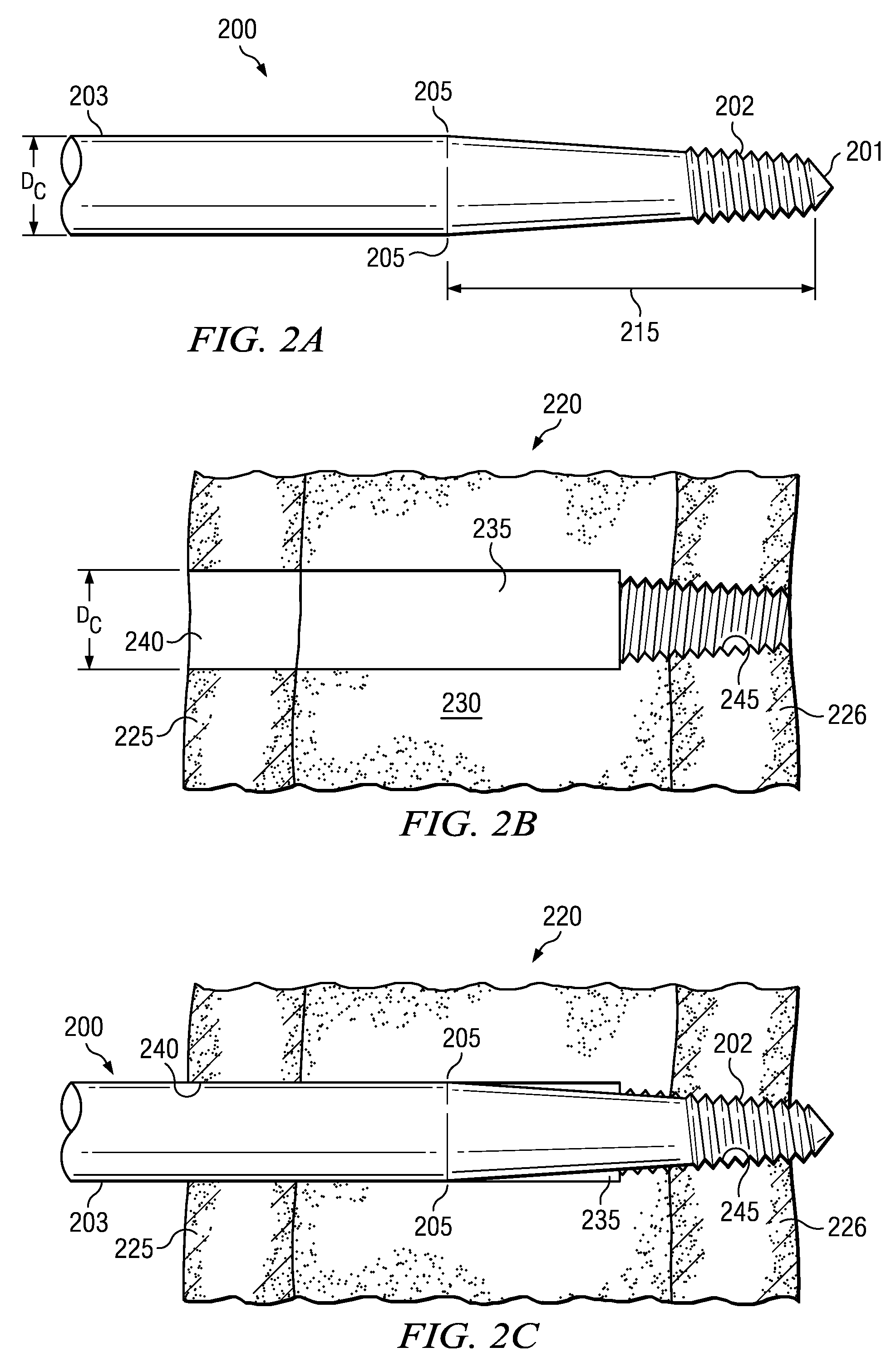 Tapered threaded orthopedic fastener engaging predetermined radial preloads