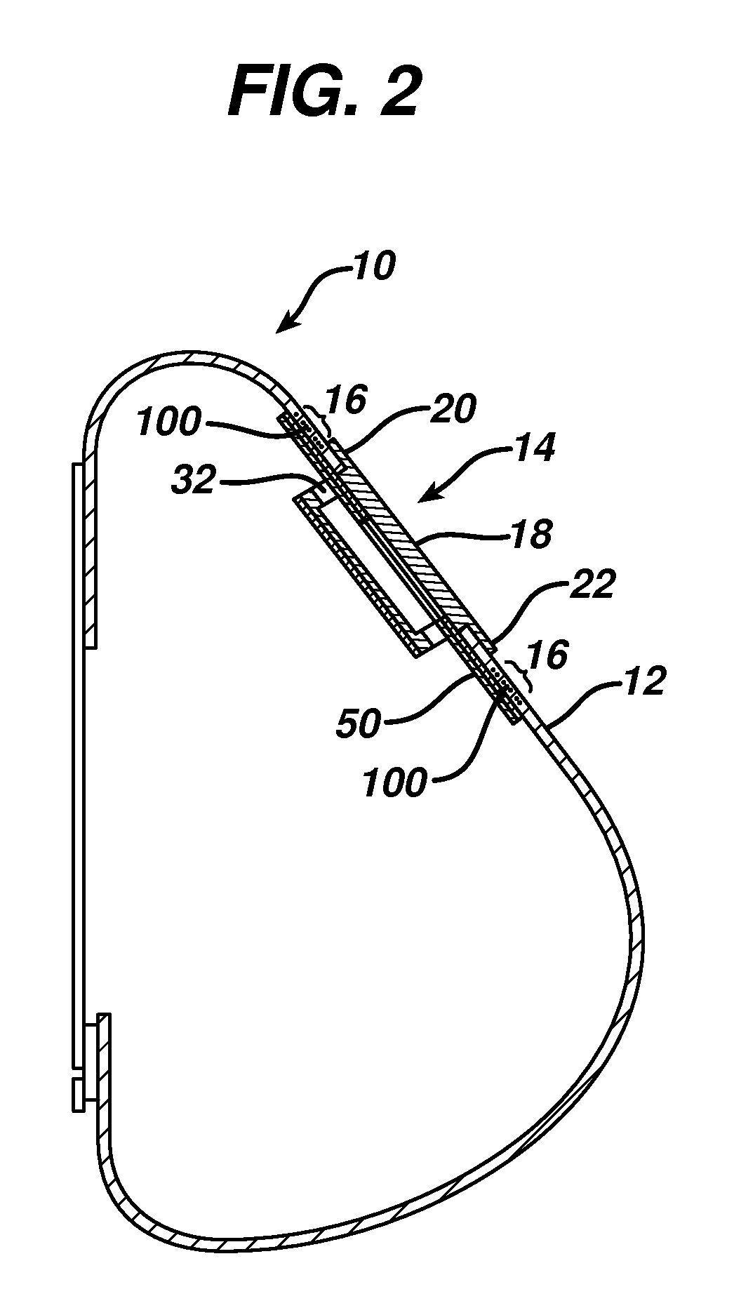 Injection zone markers for biomedical implants