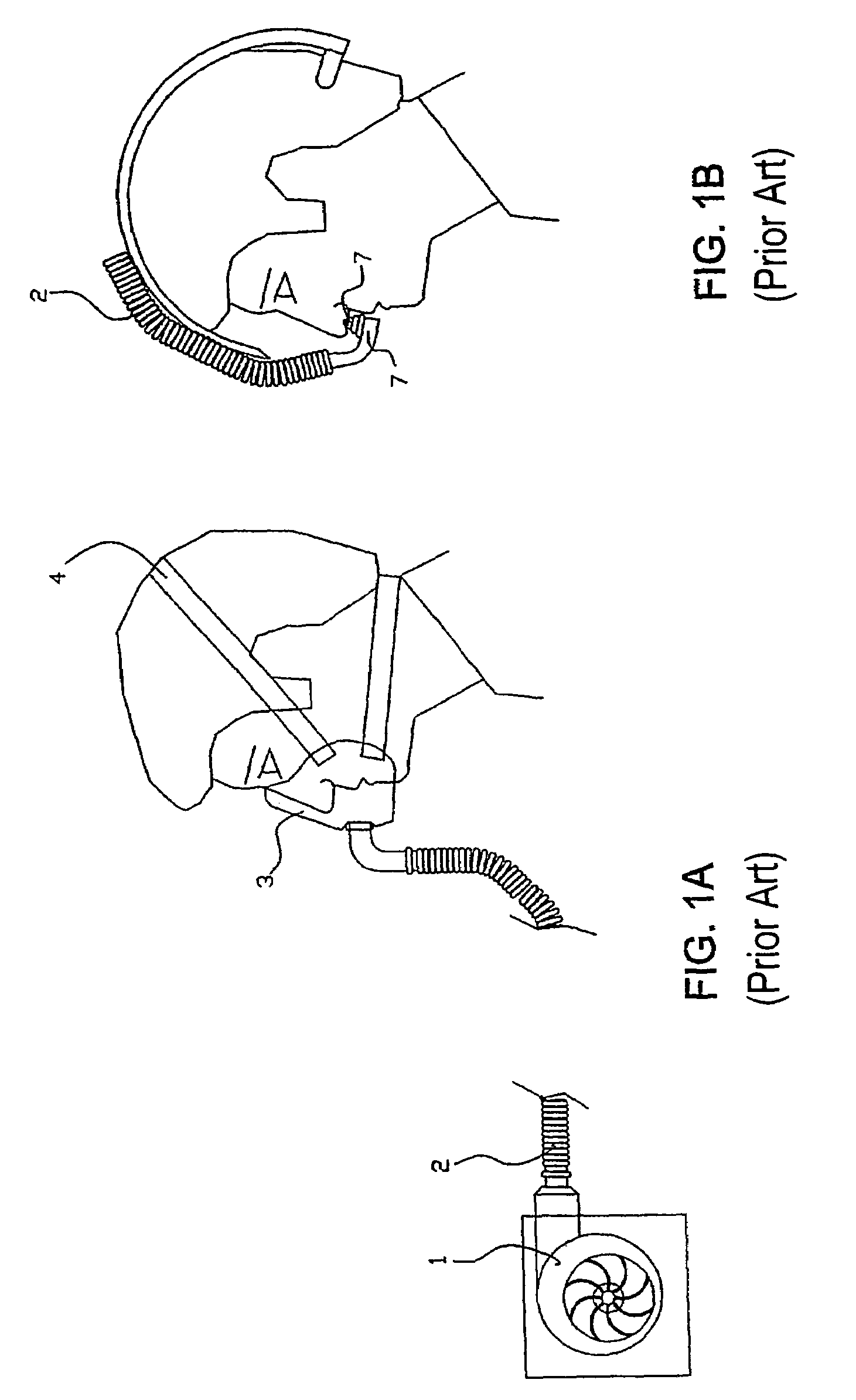 Respiratory aid apparatus and method