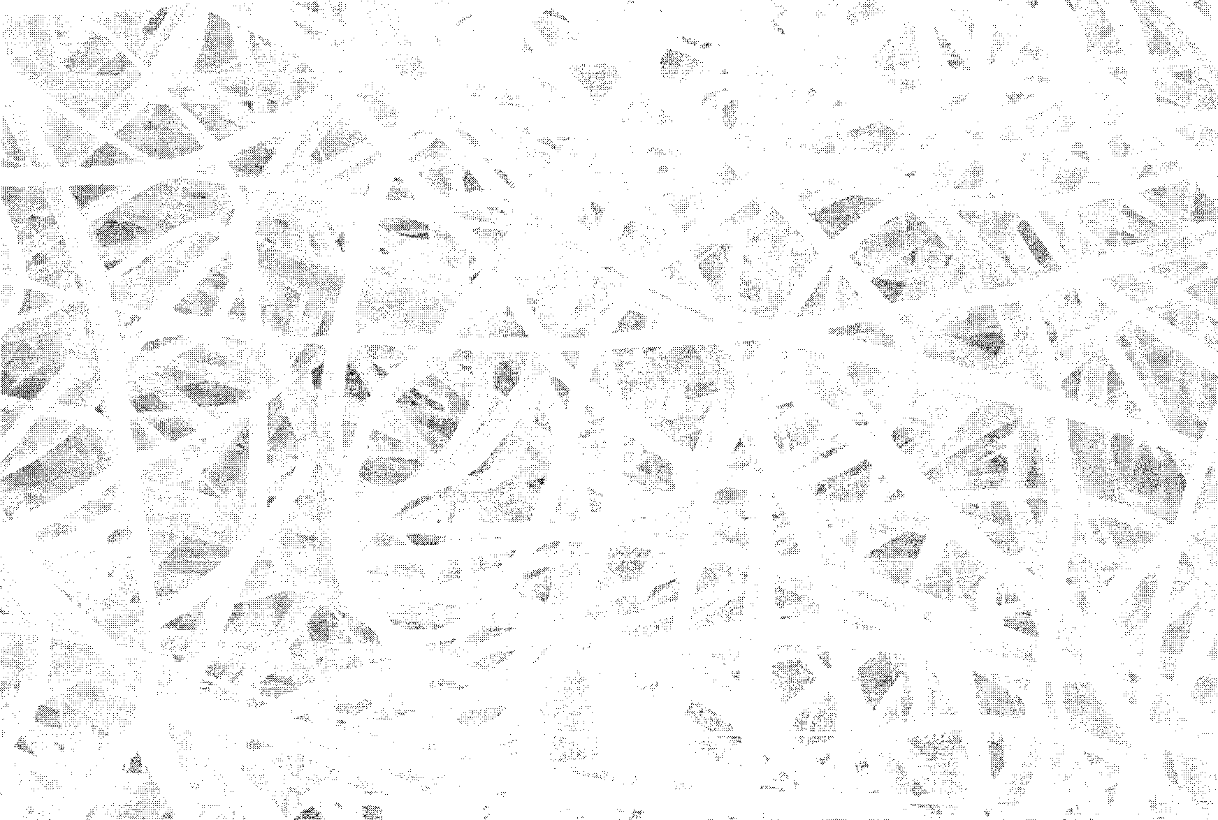 Biological absorbable polymer artificial dressing and preparation method