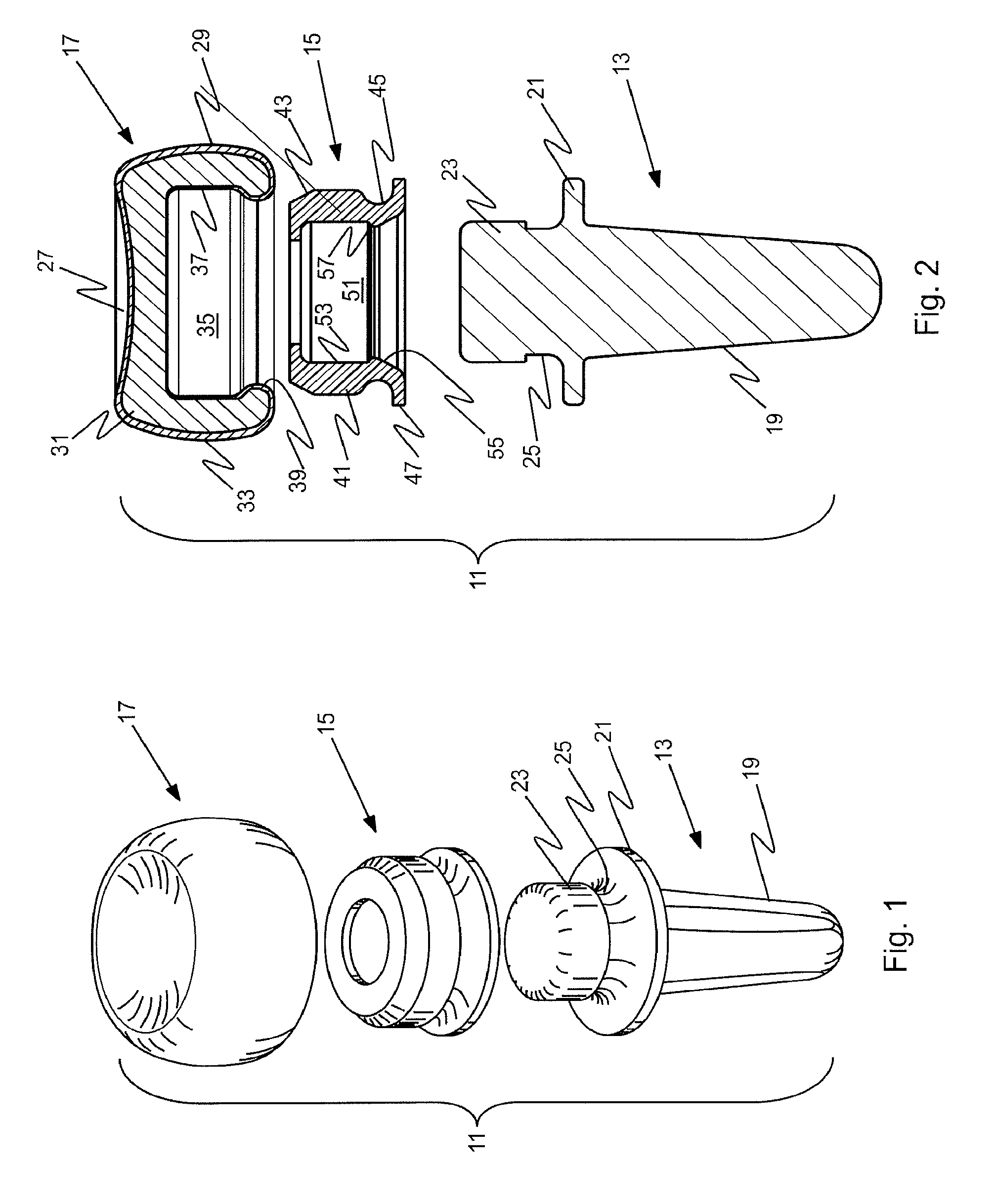 Prosthetic implant and assembly method