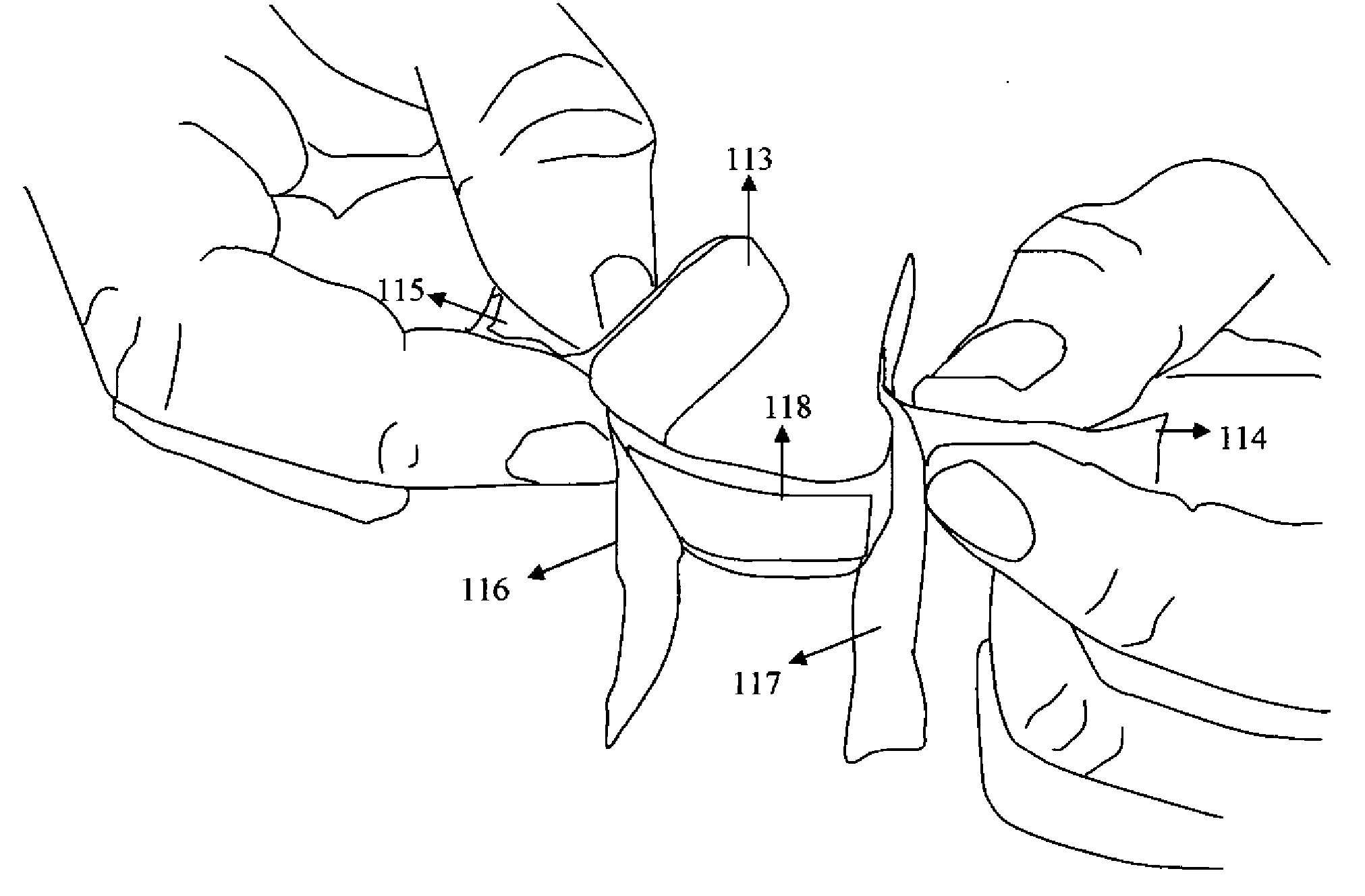 Adhesive bandage with barrier tear away tabs