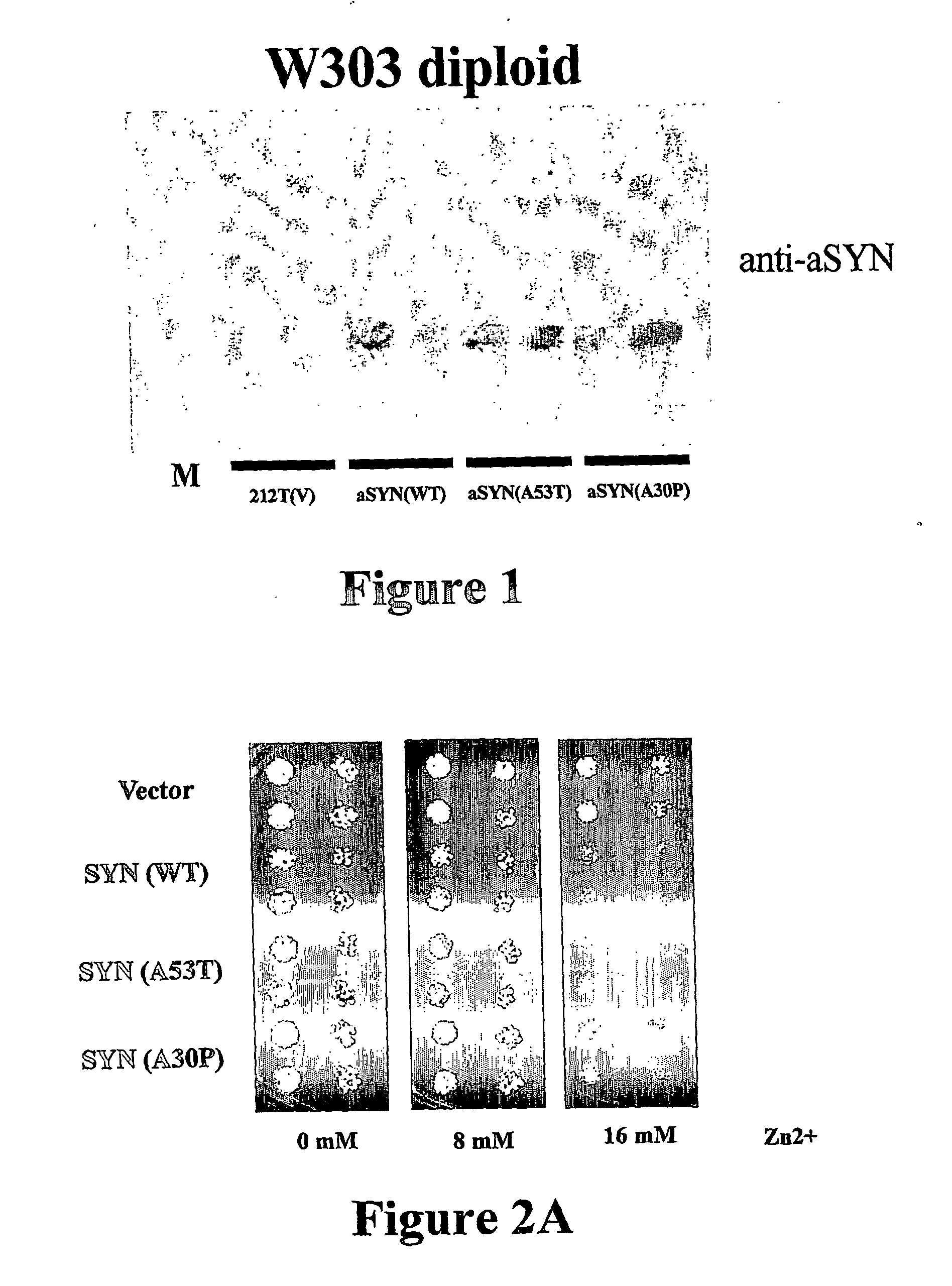 Yeast model for amyloidogenic protein toxicity