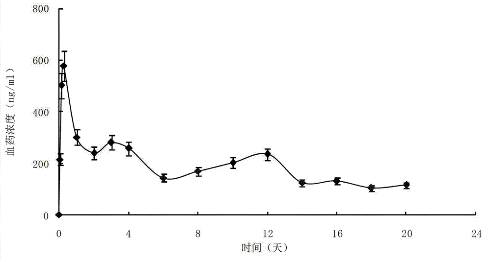 Curcumin particle suspension used for intramuscular injection and hypodermic injection, preparation method and application