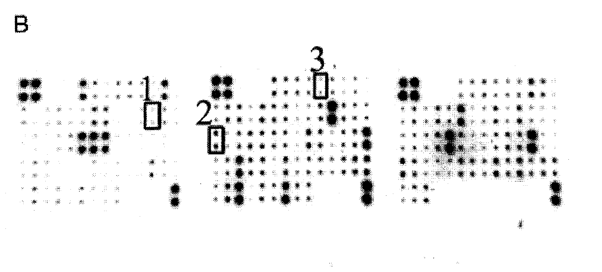 Preparation method of immunochromatography test paper for detecting premature rupture of fetal membranes