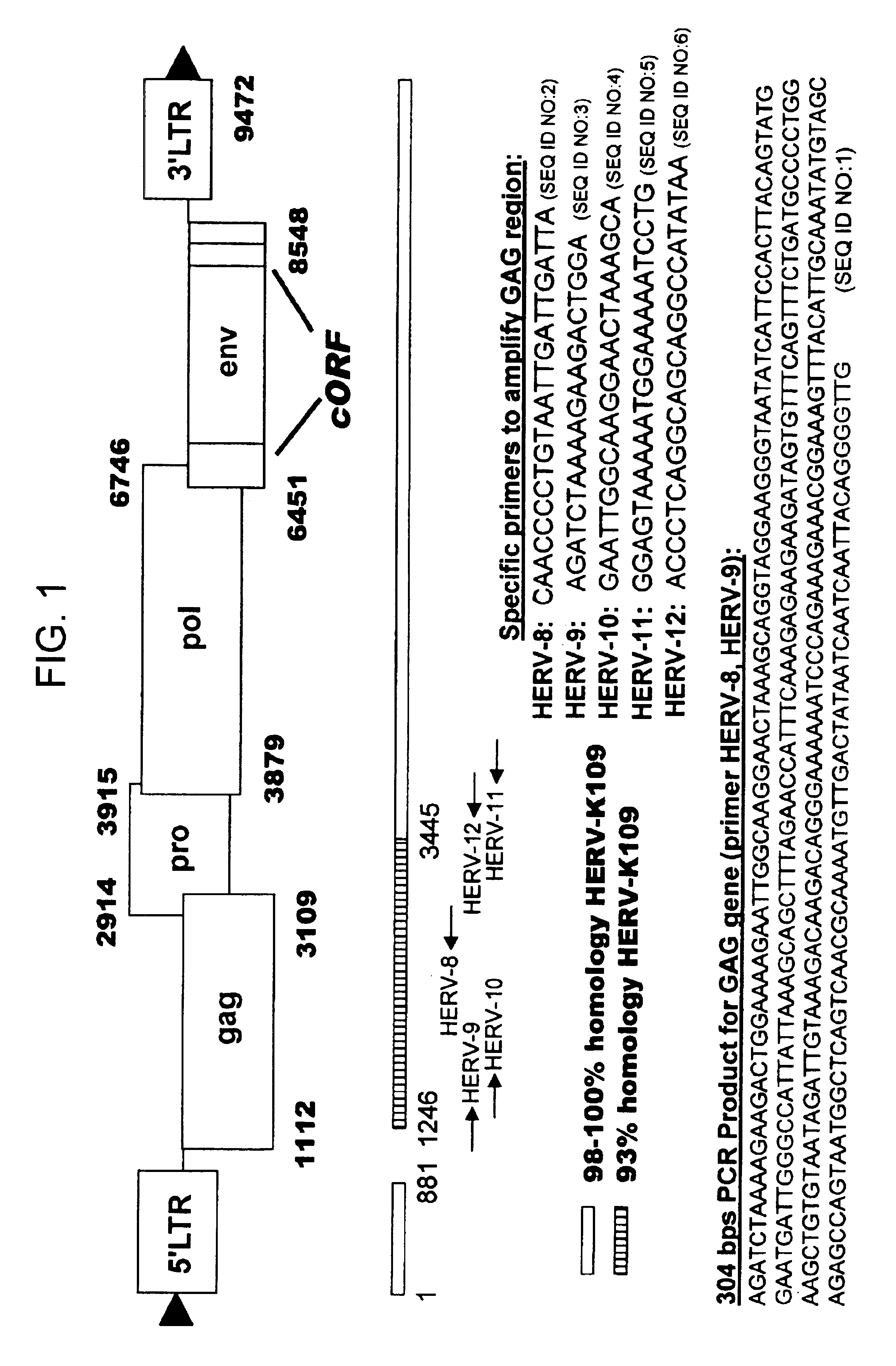 Retrovirus isolated from mantle histiocytes in mantle cell lymphoma