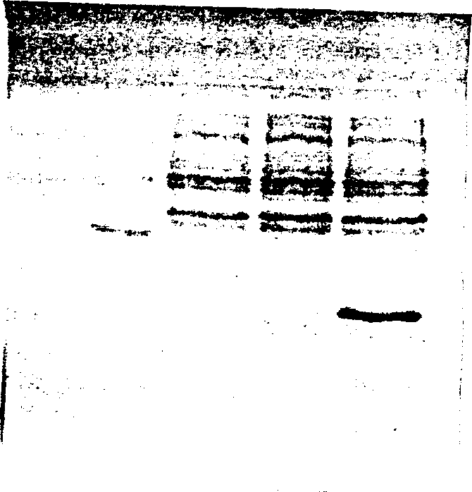 Recombination of human soluble TRAIL protein, the preparing method and the application in preparing antineoplastic medicine