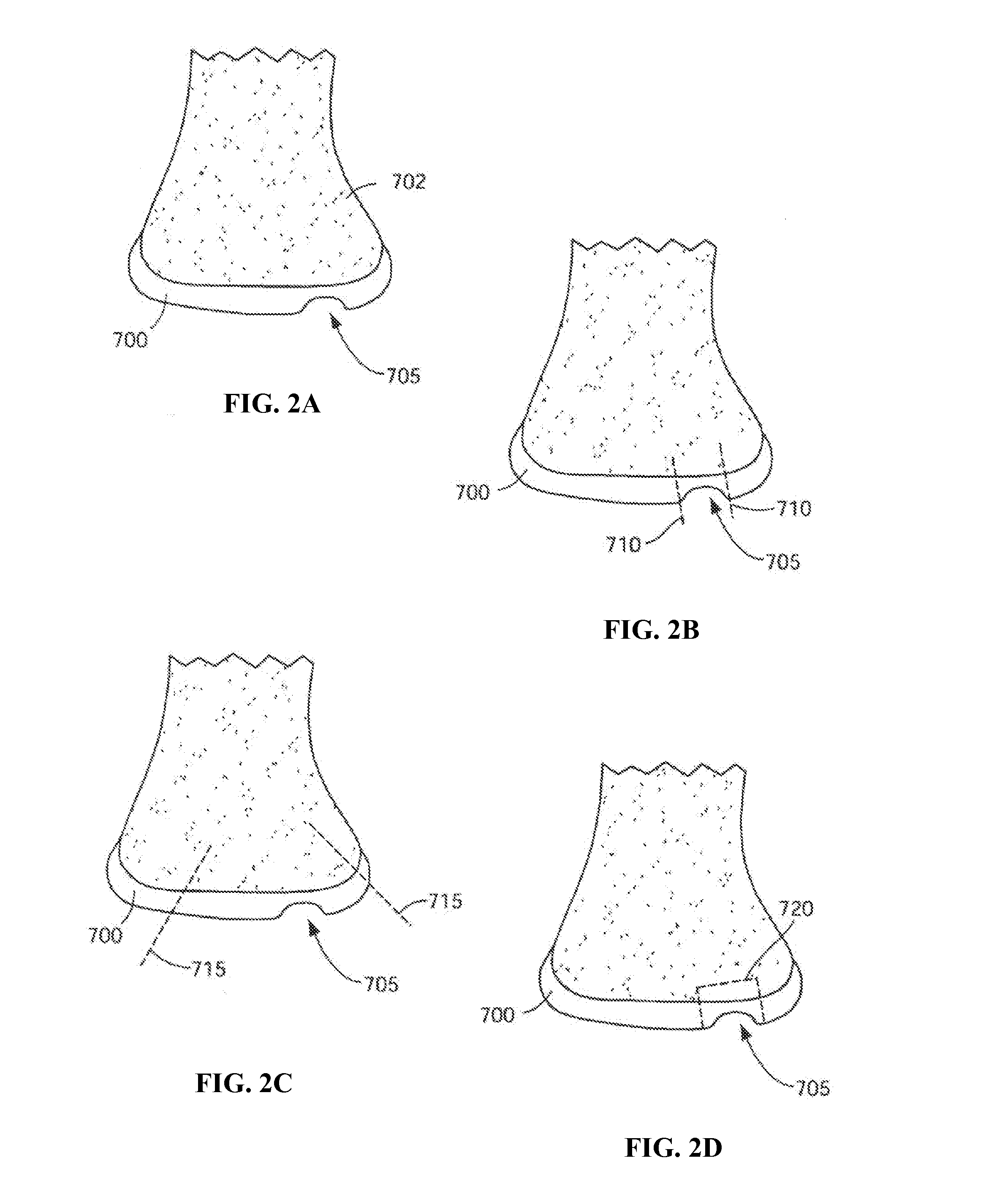 Patient selectable joint arthroplasty devices and surgical tools incorporating anatomical relief