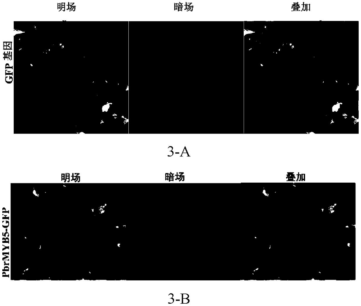 Pyrus betulaefolia cold-resistant factor PbrMYB5 and application thereof