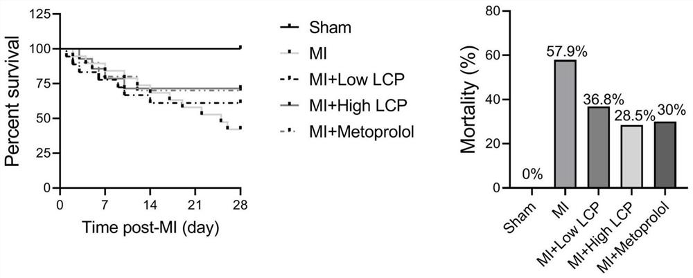 Application of lactucopicrin in preparation of medicine for preventing and treating heart failure and pathological cardiac remodeling