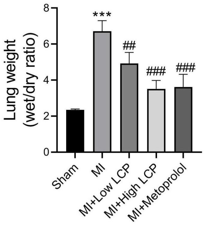 Application of lactucopicrin in preparation of medicine for preventing and treating heart failure and pathological cardiac remodeling